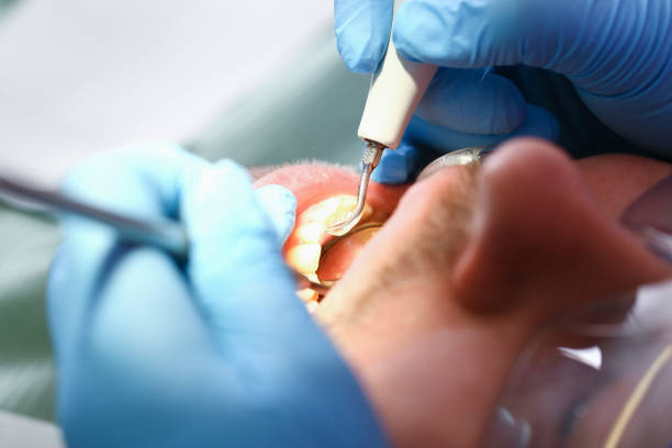Best Broken or Chipped Tooth Repair in Dothan, AL