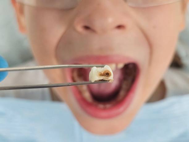 Best Emergency Pediatric Dental Care in Dothan, AL